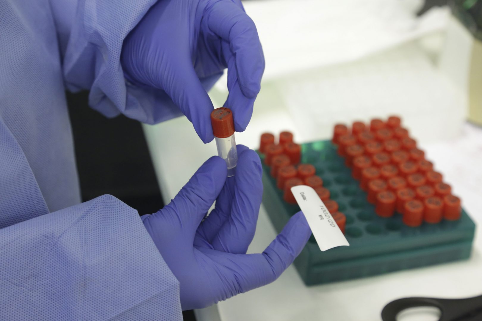 Pesquisa da UFRGS desenvolve testes rápidos para o coronavírus