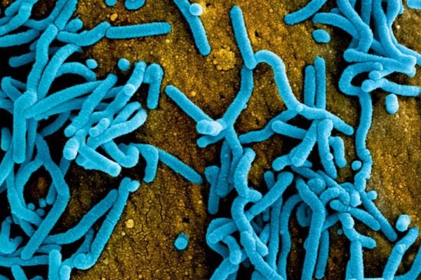 OMS confirma 2 mortes em Gana por Marburg, vírus da família do Ebola