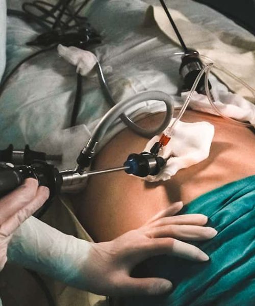 Minimamente invasiva ou cirurgia tradicional? Vantagens e desvantagens